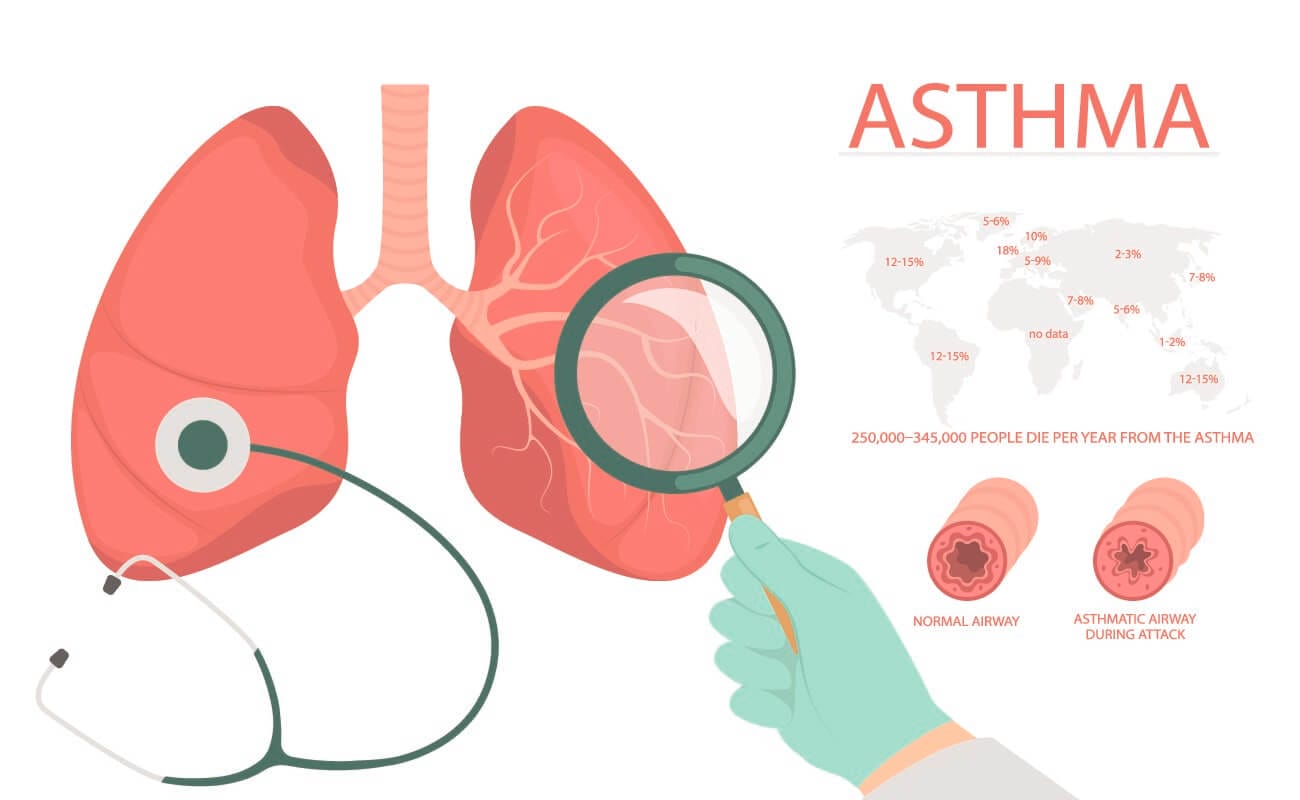 Beta Blocker In Asthma